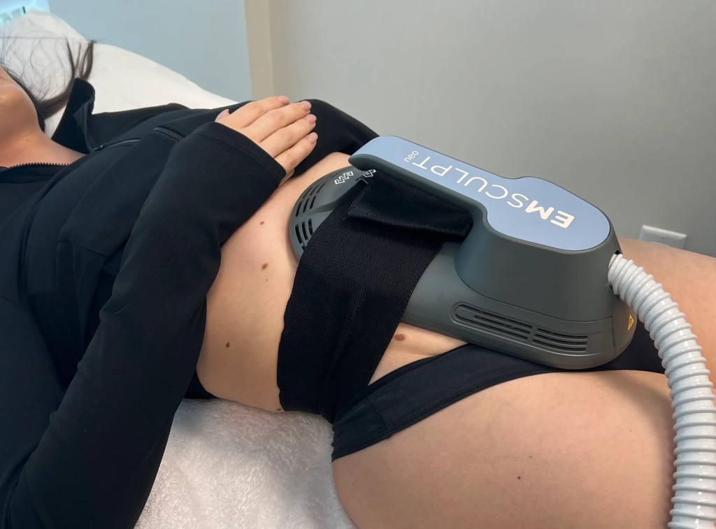 Emsculpt Neo session in progress at iCRYO SouthPark