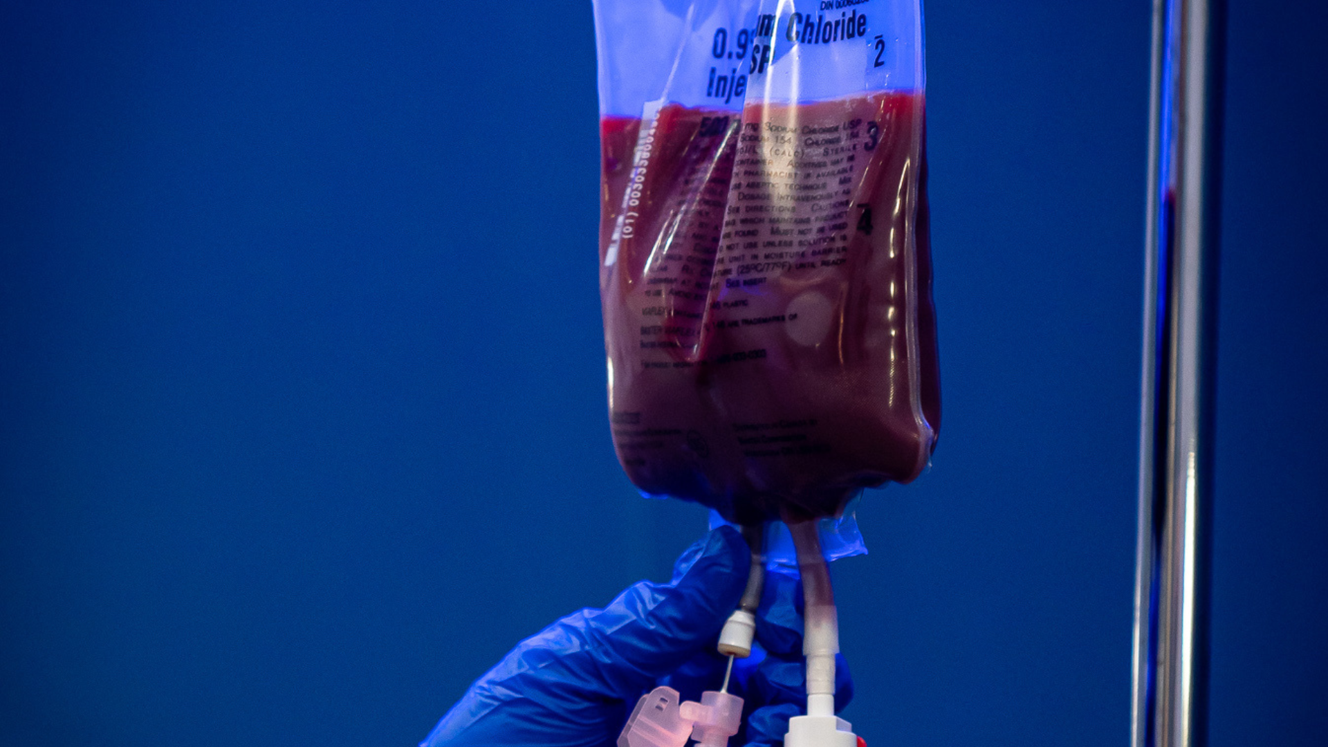 Ozone UV IV therapy treatment for advanced immune support